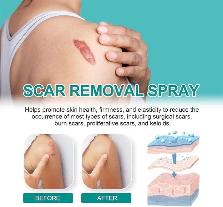 ScarRemove+ Advanced Spray Fade Scars
